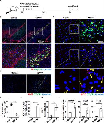 Myeloid-specific blockade of notch signaling alleviates dopaminergic neurodegeneration in Parkinson’s disease by dominantly regulating resident microglia activation through NF-κB signaling